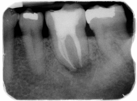 Nooshin Vasfi in Dental Surgery Milton Keynes Endodontist