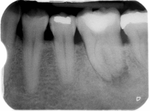 Nooshin Vasfi in Dental Surgery Milton Keynes Endodontist