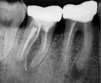 Nooshin Vasfi in Dental Surgery Milton Keynes Endodontist