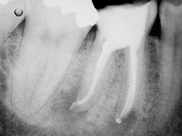 Nooshin Vasfi in Dental Surgery Milton Keynes Endodontist