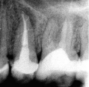 Nooshin Vasfi in Dental Surgery Milton Keynes Endodontist