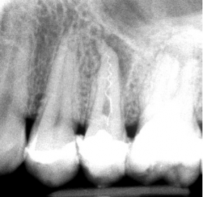 Nooshin Vasfi in Dental Surgery Milton Keynes Endodontist